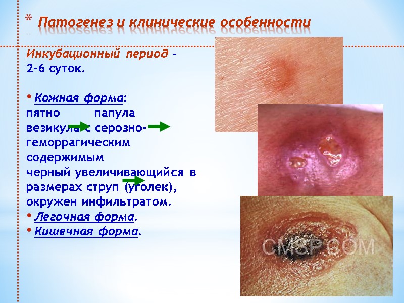 Патогенез и клинические особенности  Инкубационный период –  2-6 суток.  Кожная форма: